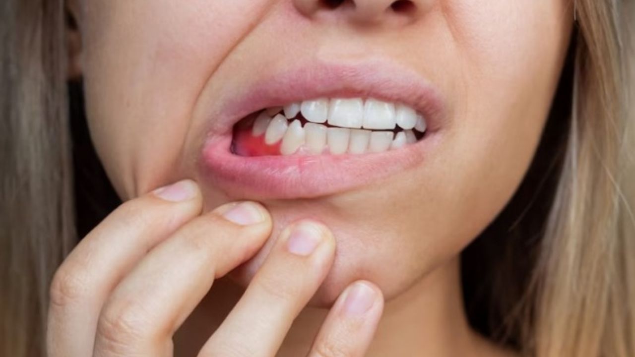 Yetersiz C vitamini alımı neden oluyor!