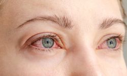 50 Yaş Altı Körlüğün Birinci Nedeni: Diyabetik Retinopati!