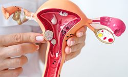 Birçok Kadında Var Ancak Fark Edilmiyor: Miyom Gerçeği!