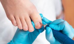 Mantar Hastalığı Nedir? Mantar Hastalığı Nasıl Geçer?