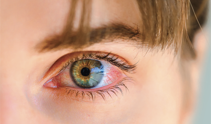 Uzmanı Açıkladı: Göz Muayenesi Hayat Kurtarır!