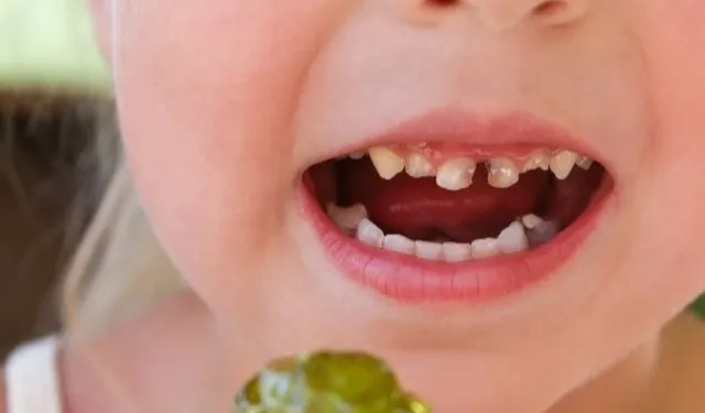 Paketli gıdalar çocuk dişlerini vuruyor!